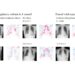 Chest radiographs and average saliency maps