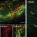 Neuroscience of Placebo Effect