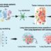 Key Immune Cells as Critical Factors in Lung Cancer Prognosis