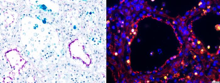 Infected mammary glands under microscope