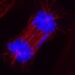 Abnormal cell division in RNF144B altered cell.