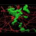 Amyloid beta plaque in neurons modeling late-onset Alzheimer's disease