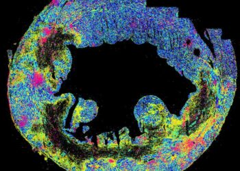 Clustered IFN responses (pink) at the borderzone of an infarcted heart