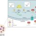 The roles of m6A RNA modification in leukemia