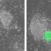 Before and after interferon gamma treatment