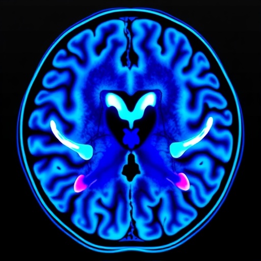Rewrite Gadoxetic acid-enhanced MRI for identifying cholangiocyte phenotype hepatocellular carcinoma by interpretable machine learning: individual application of SHAP as a headline for a science magazine post, using no more than 7 words