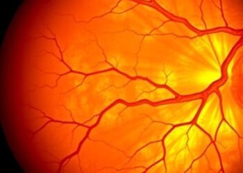 Histologic Chorioamnionitis Linked to Severe Retinopathy