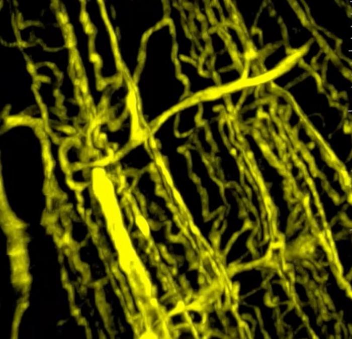 A microscopy image of the three-dimensional blood vessel network in a healthy muscle.