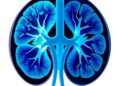 AI Advances Kidney Stone Diagnosis Through Imaging