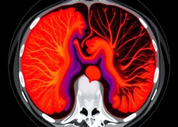 AI/ML Advances in LDCT Reconstruction: A Review