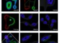 EBLN3P Enhances Gastric Cancer Growth and Spread