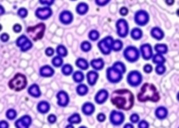 Exploring Histopathology in Peste des Petits Ruminants