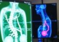 HKMU Secures First Technology License: A Leap Forward in Non-Invasive Prostate Cancer Screening Commercialization