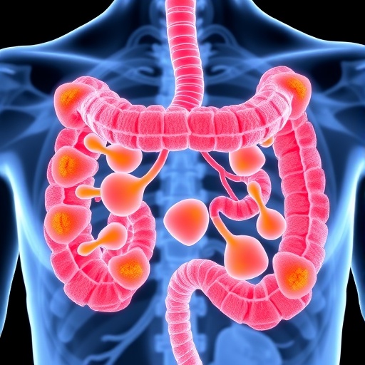 Lymph Node Subtypes Reveal Colorectal Cancer Insights