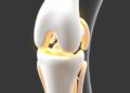 3D Knee Brace Joint Created via MRI and Algorithms
