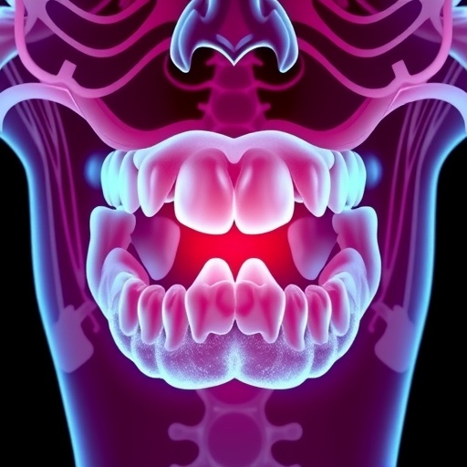 Study finds gum disease and cavities may elevate risk of stroke ...