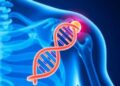 Unraveling the Link: Genetic Connections Between Osteoporosis and Rotator Cuff Tears