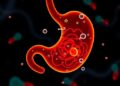 Microbiota Shifts Linked to Intragastric Balloon Use