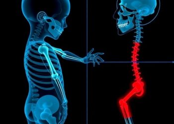 Advancing Pediatric Sarcopenia Diagnosis: New Insights
