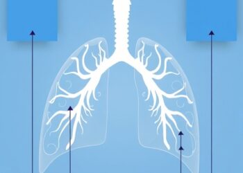 Charlson Index Predicts 28-Day Mortality in Respiratory Failure