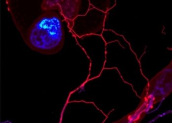 Proteomic Analysis of Fetal Membrane Defect Sites