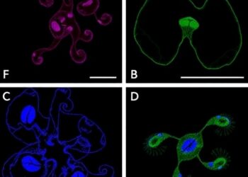 Type I Interferon β Boosts Anti-Tumor Activity in Bladder Cancer