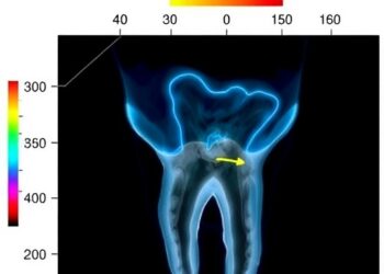 AI Predicts Tooth Extraction with Limited Imaging Data