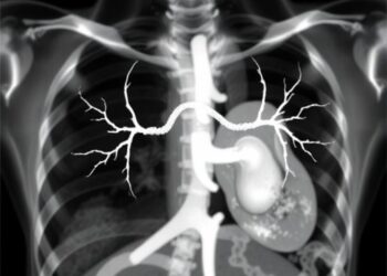 Cardiomyopathy Severity and Variants in DMD Patients