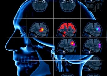 Enhanced Alzheimer’s Detection via Machine Learning Optimization