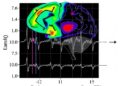 Enhancing EEG Analysis in Language Learning through Feature Selection