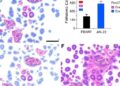 FBXW7 Modulates M2 Macrophage Polarization in Endometrial Cancer