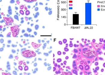 FBXW7 Modulates M2 Macrophage Polarization in Endometrial Cancer