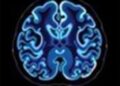 Federated Learning Enhances Alzheimer’s Imaging Assessment