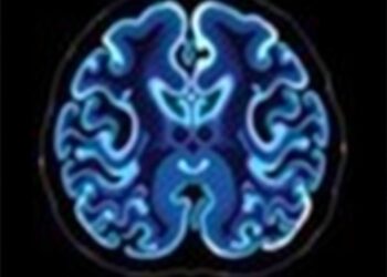 Federated Learning Enhances Alzheimer’s Imaging Assessment