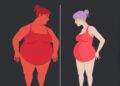 Gender Differences in Obesity and Stroke Outcomes