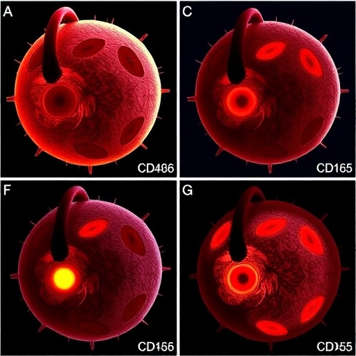 Impact of CD46 and CD55 in Leukemia Phases