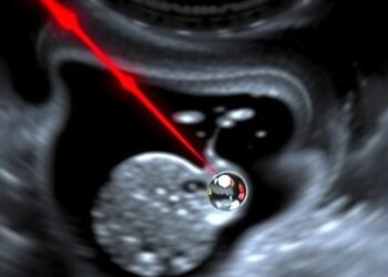 Laser-Activated Nanodroplets Enable Photo-Activated Ultrasound Imaging