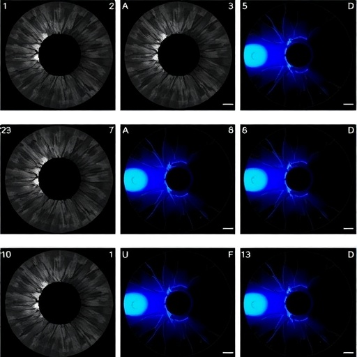 Optimized U-Net Model for Retinal Disc Segmentation