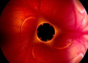 Optoacoustic Mesoscopy Fixes Single-Capillary Endothelial Dysfunction