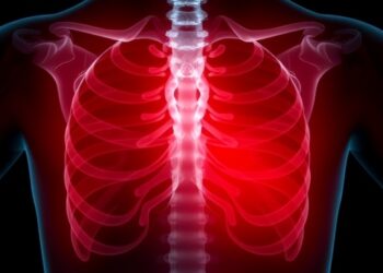 Romosozumab Outperforms PTH Analogs in Fracture Prevention