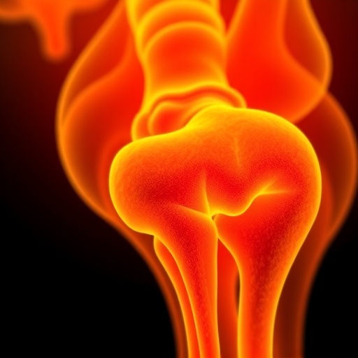 Targeting OxLDL Boosts PD-1 Immunotherapy in Osteosarcoma