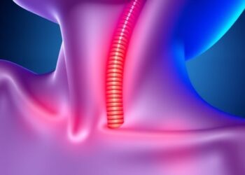 Wireless Implant Tracks Airway Stent Migration Continuously