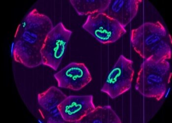 120 nm Label-Free Imaging Inside Live Cells