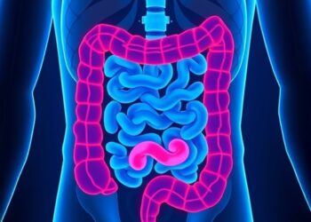 AI Technology Forecasts Colorectal Cancer Risk in Ulcerative Colitis Patients