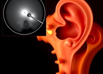 Innovative Medical Imaging Technology Enhances Precision in Cochlear Implant Bone Removal Surgery