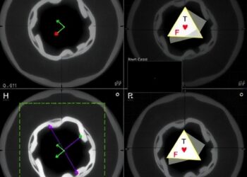 Multichannel Motion-Compensated Imaging of Moving Targets