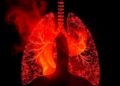 New Study Uncovers Mechanism Behind Burn Pit Particulate Matter–Induced Lung Inflammation