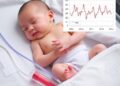 Real-Time Heart Responses to Blood Transfusions in Preemies