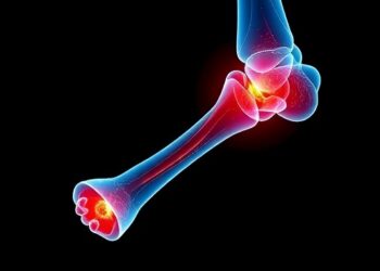 Scientists Identify Key Molecular Trigger Behind Failed Healing of Certain Broken Bones