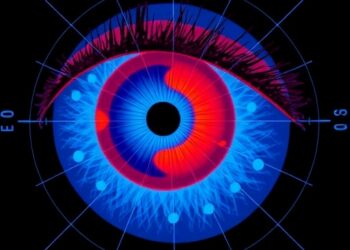 AI-Enhanced Eye Imaging Reveals New Insights into Cardiovascular Risk